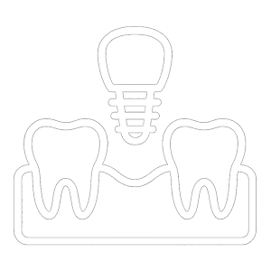 Implants