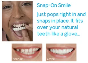 Snap On Smile